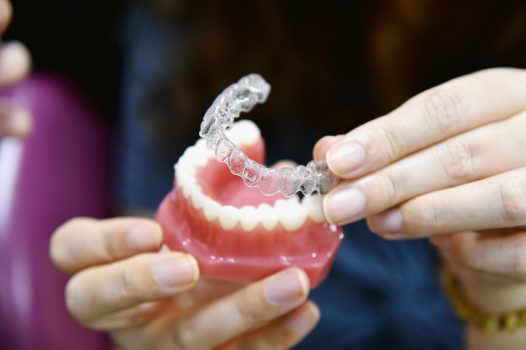 Inivisalign braces or aligner. Dentist advice how invisible orthodontics make beautiful teeth in dental clinic.